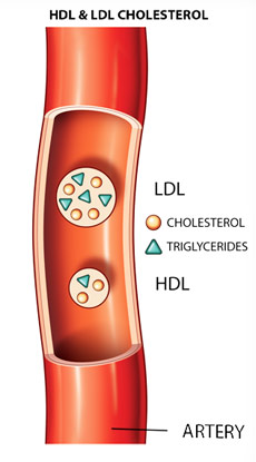 The Good, Bad, and Ugly about Cholesterol