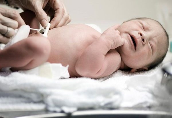 Delayed Cord Clamping: Pros & Cons