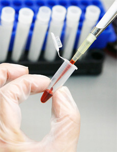 New test detects antibodies that attack HIV