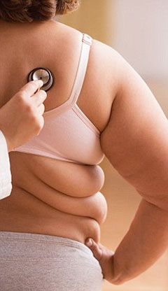 Obese Women more likely to Die before Age 85