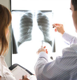 Lung cancer not on many women's radar 