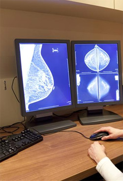 False negative results found in prognostic testing for breast cancer