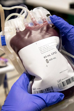 Heart Surgery and Transfusions: Blood Conservation