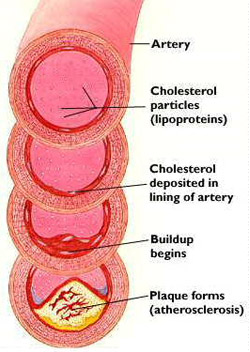 Socioeconomic status and gender are associated with differences in cholesterol levels 