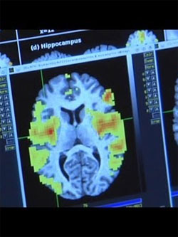 Eating habits, body fat related to differences in brain chemistry   