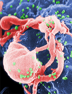 HIV may become less infectious over time, study says    