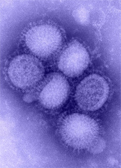 Flu cases surge beyond alert level, signaling pandemic