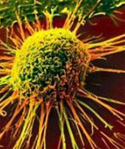 Collaborative research team solves cancer-cell mutation mystery