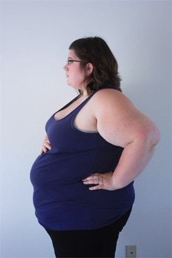 Obesity, mood disorders increase peripartum cardiomyopathy risk during child birth: A Study