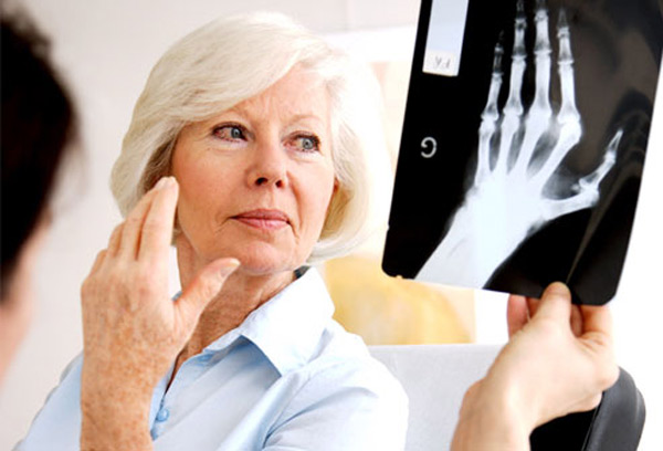 Rheumatoid-arthritis-disease
