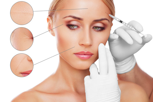 Facelift-surgery