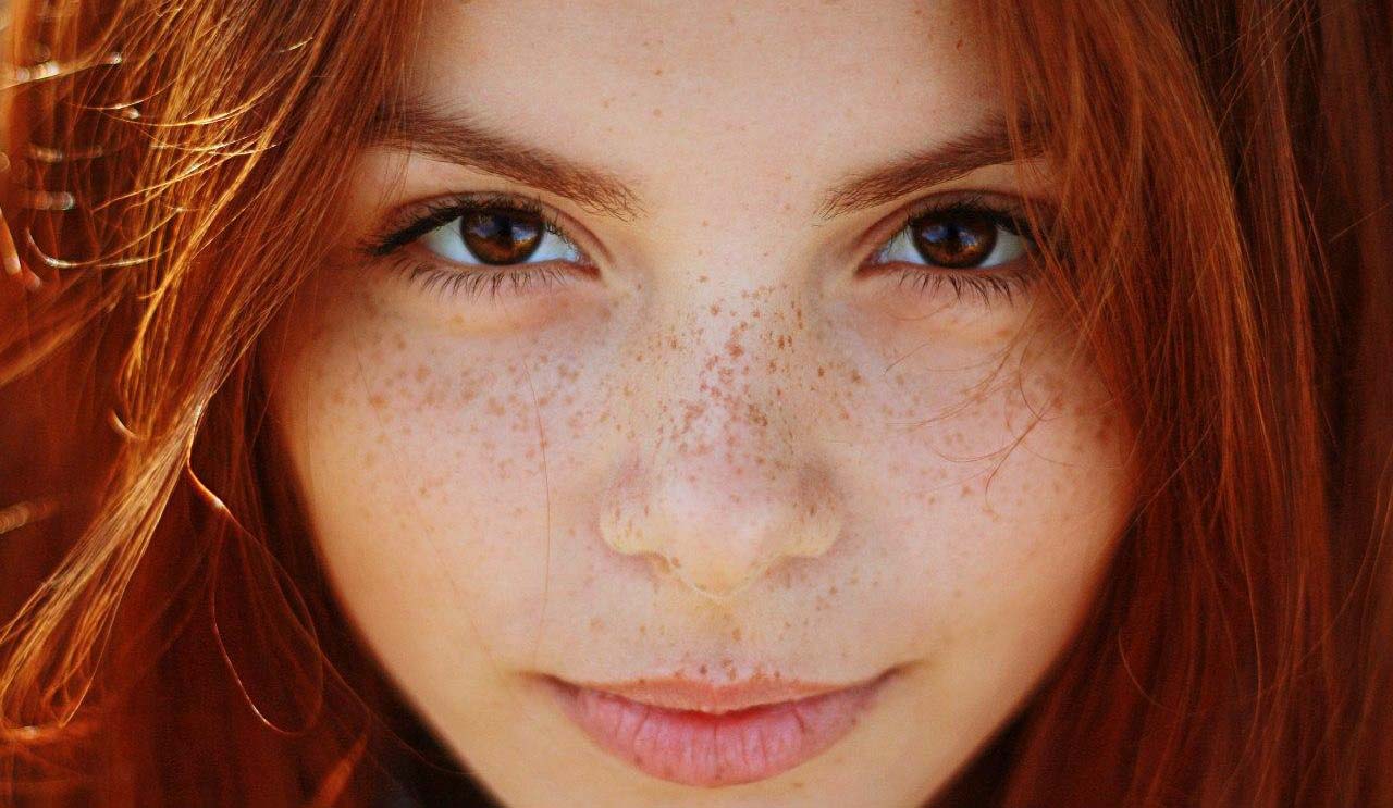 Lovely freckles