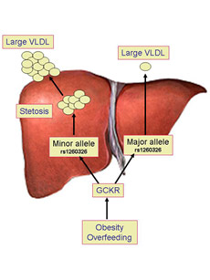 Non Alcoholic Fatty Liver Disease: Are You at Risk?