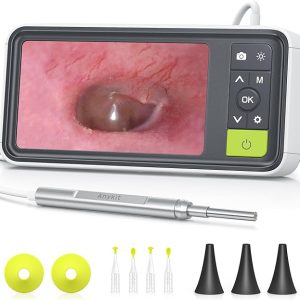 Anykit Digital Otoscope with Gyroscope, 4.5 Inches Screen, 3.9mm Ear Scope Camera with 6 Lights, Ear Wax Removal Tool