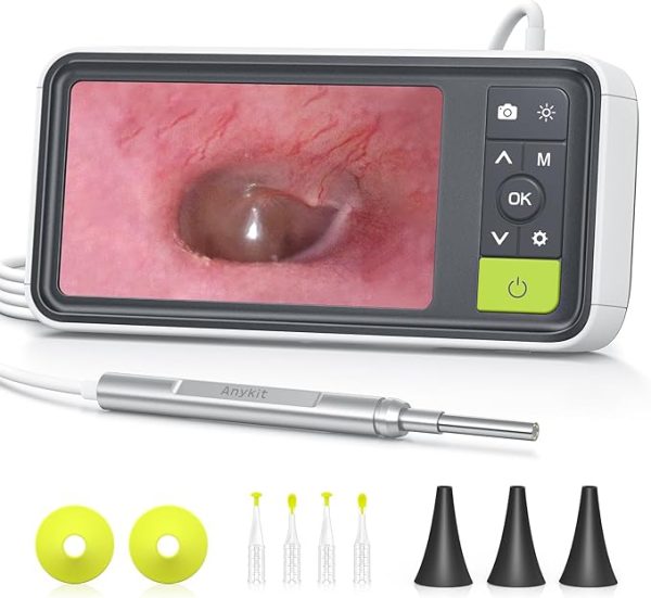 Anykit Digital Otoscope with Gyroscope, 4.5 Inches Screen, 3.9mm Ear Scope Camera with 6 Lights, Ear Wax Removal Tool