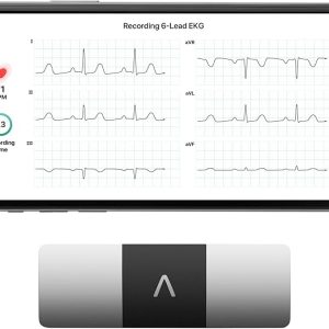 KardiaMobile 6-Lead Personal EKG Monitor – Six Views of The Heart – Detects AFib and Irregular Arrhythmias – Instant Results in 30 Seconds – Works with Most Smartphones - FSA/HSA Eligible