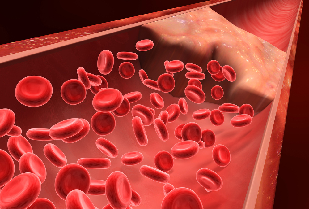 Nanoparticles That Speed Blood Clotting May Oneday Save Lives Women 