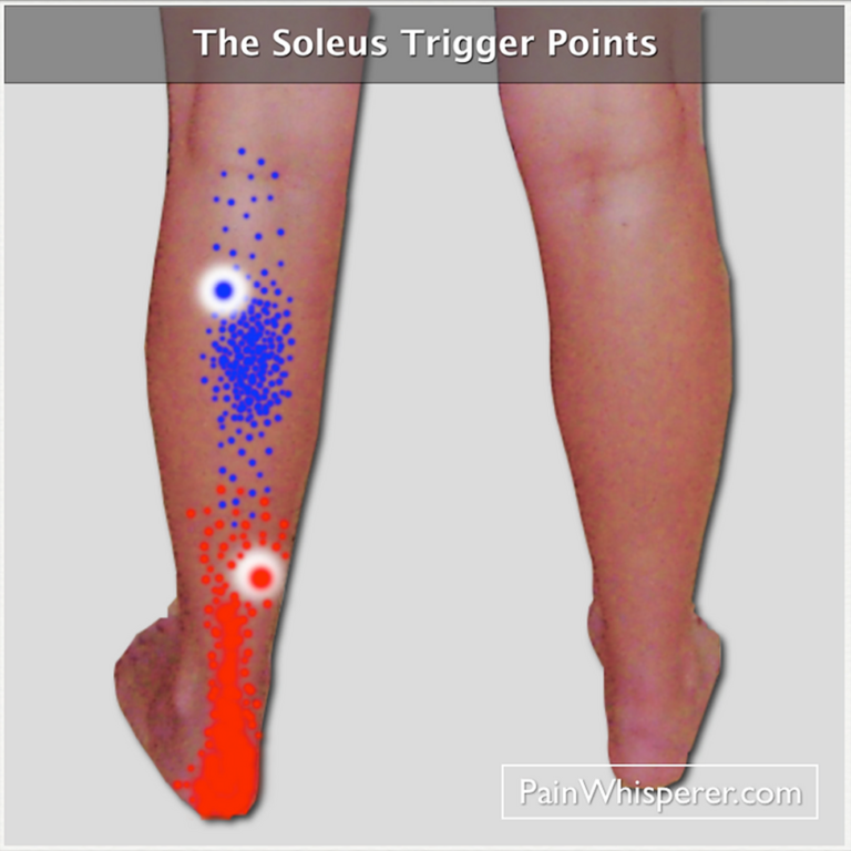 Trigger Point Therapy for Calf, Ankle & Foot Pain - Women Fitness