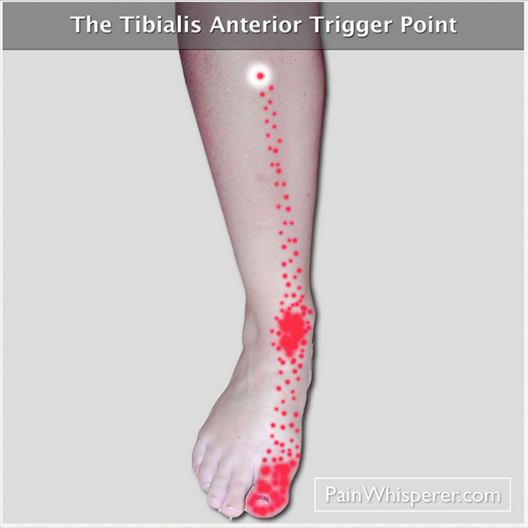 Trigger Point Therapy for Calf, Ankle & Foot Pain - Women Fitness